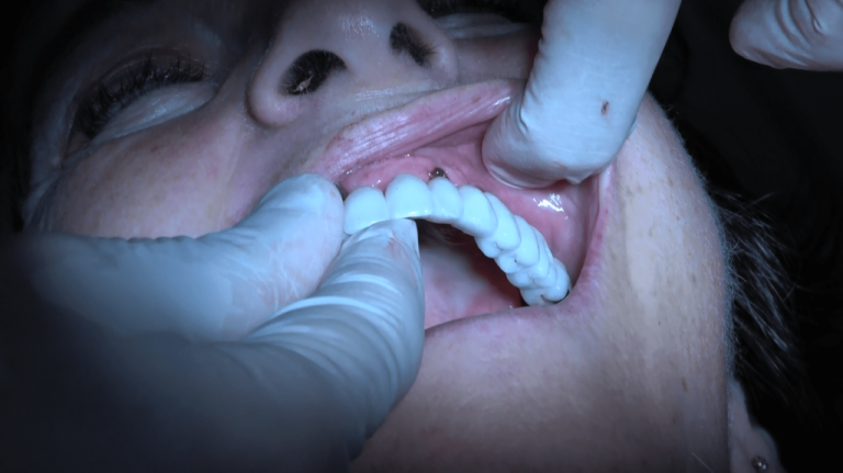 Chi sono i medici di Implantologia Network e perché affidarti a loro è l’unica vera garanzia