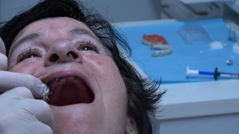 Osso alveolare vs osso basale: il vero segreto per mettere i denti fissi quando ti dicono che “non hai osso”